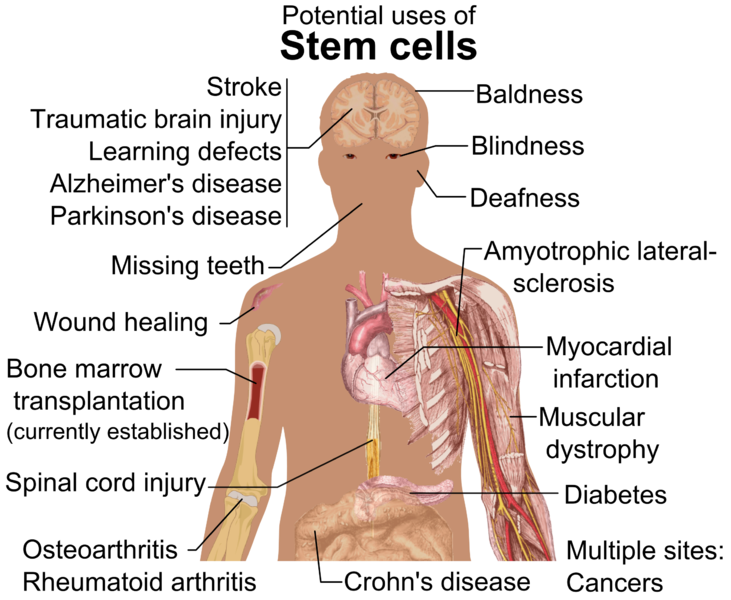 Stem Cell, Other Techniques To Fight Chinese Coronavirus Emerge