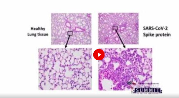 A PATHOLOGIST SUMMARY OF WHAT THESE JABS DO TO THE BRAIN AND OTHER ORGANS