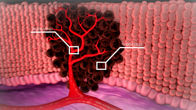 DO COVID-19 "VACCINES" CAUSE CANCER?