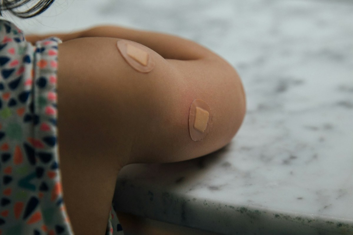A child’s upper arm with two adhesive bandages after vaccination